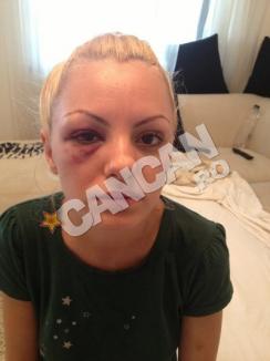 Alexandra Stan, desfigurată de manager: A fost bătută şi aruncată din maşină